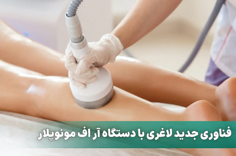 لاغری با دستگاه آر اف مونوپلار