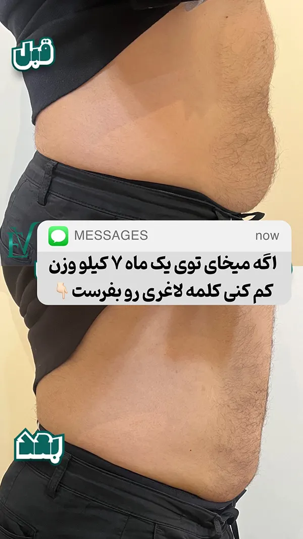 لاغری با آر اف