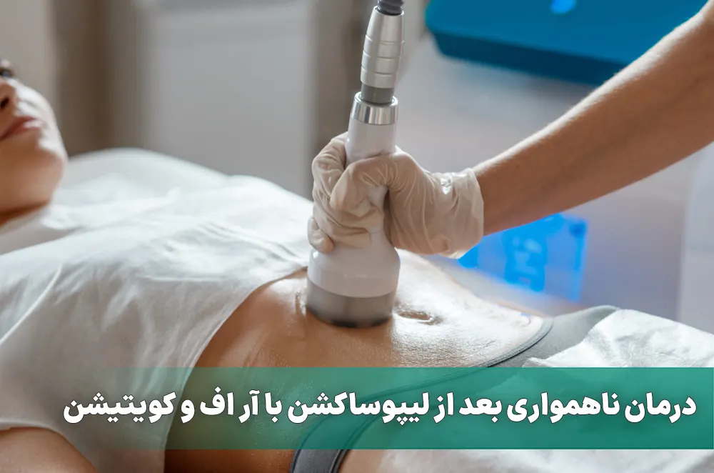 درمان ناهمواری بعد از لیپوساکشن با آر اف و کویتیشن