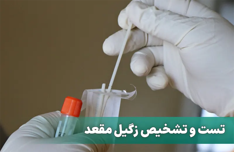 تشخیص زگیل مقعد