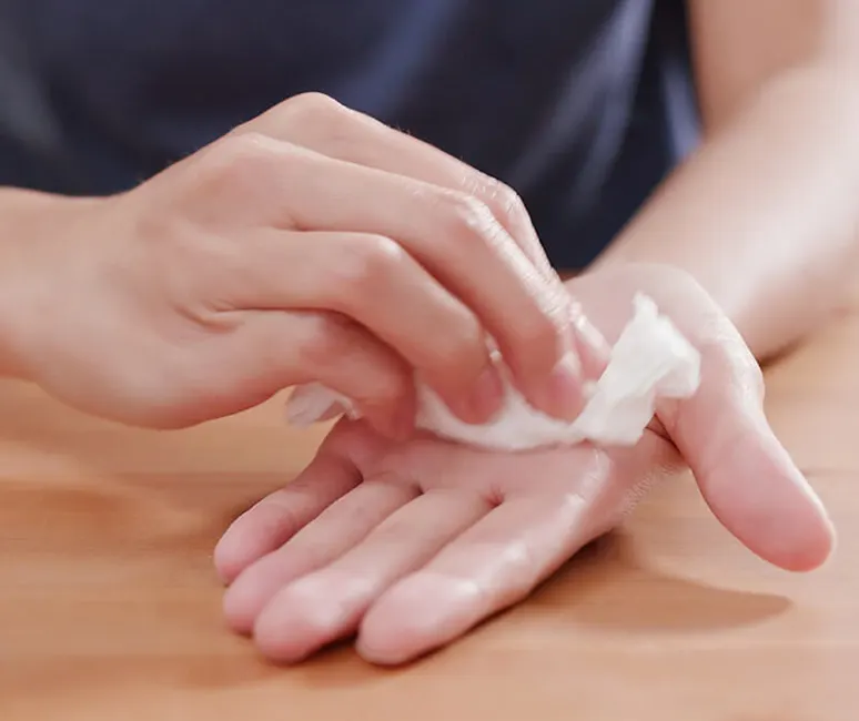 تعریق کف دست