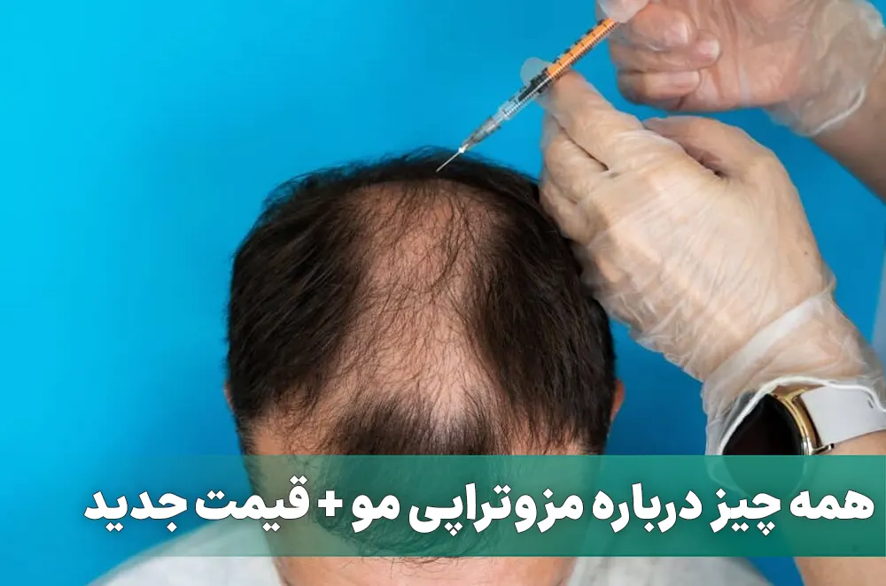 مزوتراپی مو