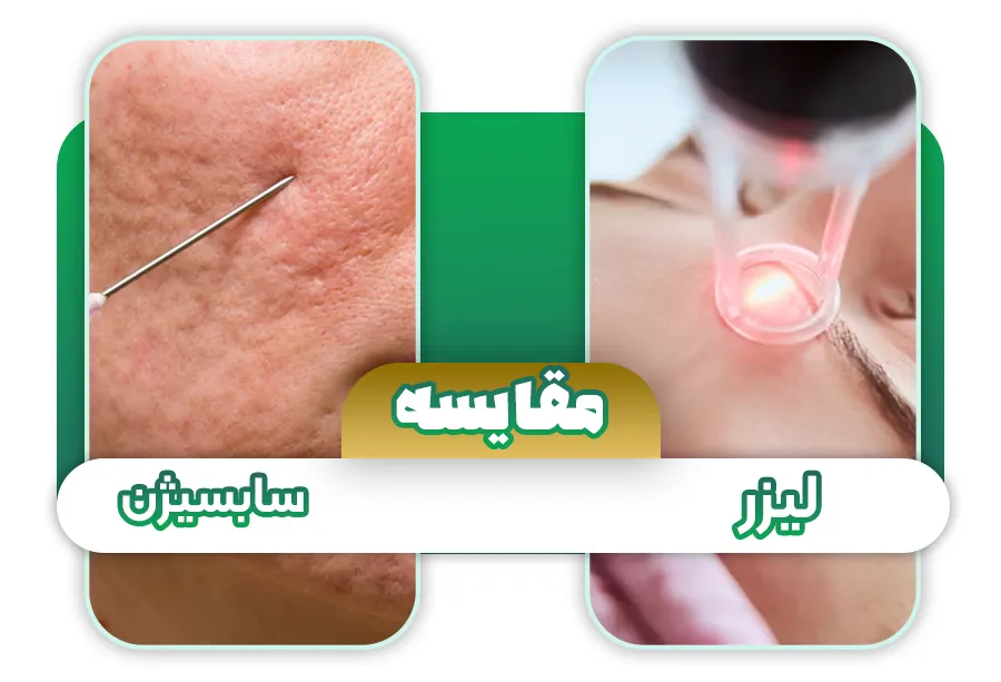 سابسیژن یا لیزر برای اسکار جوش