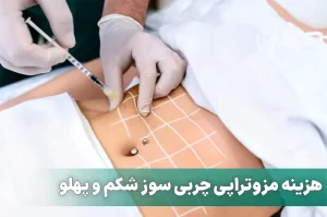 هزینه مزوتراپی چربی سوز شکم و پهلو