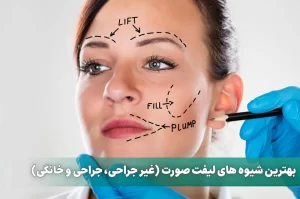 بهترین شیوه های لیفت صورت
