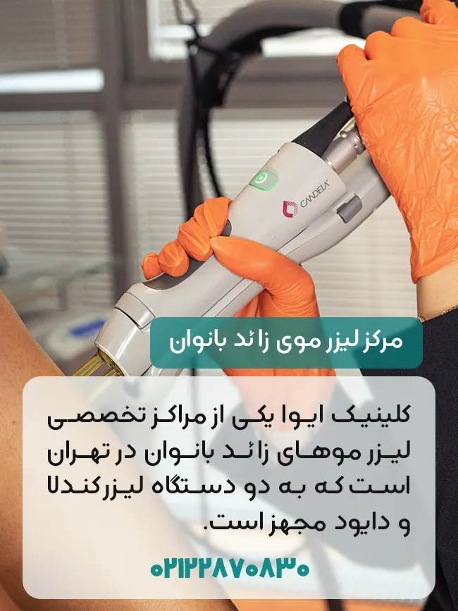 لیزر موهای زائد بانوان