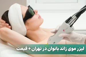 لیزر موی زائد بانوان