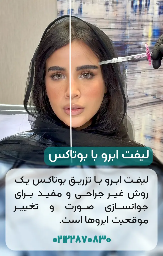 لیفت ابرو با تزریق بوتاکس