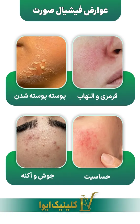 عوارض رایج فیشیال صورت