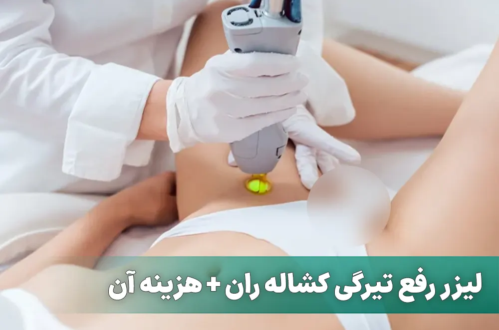 لیزر تیرگی کشاله ران