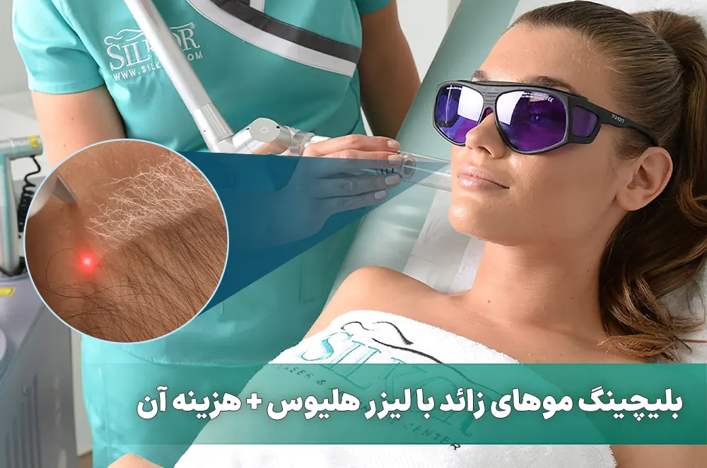 بلیچینگ موهای زائد با لیزر