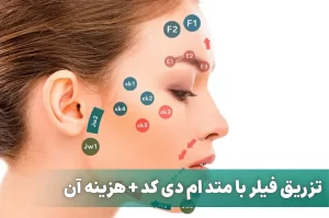 تزریق فیلر با متد ام دی کد