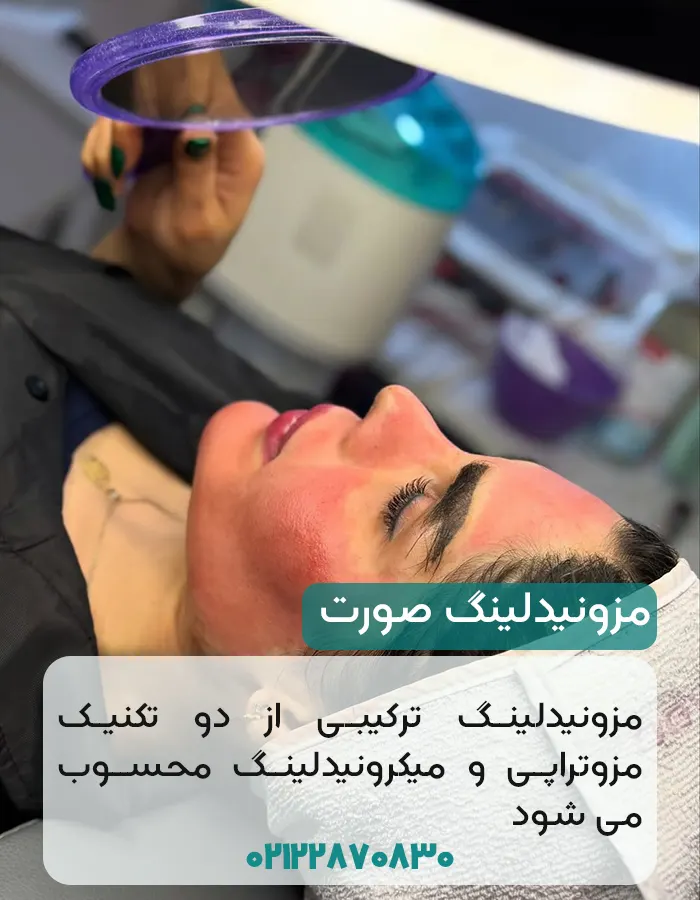 مزونیدلینگ صورت