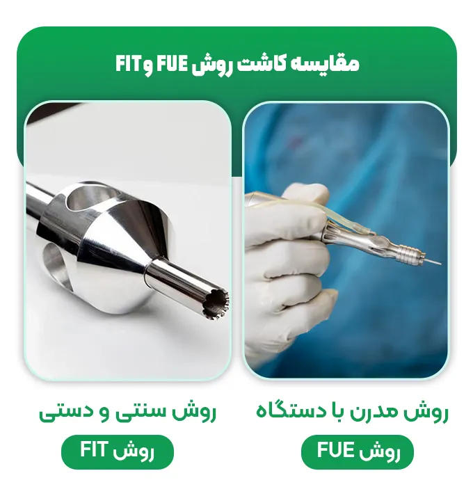مقایسه کاشت مو به روش FUE و FIT