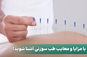 مزایا و معایب طب سوزنی