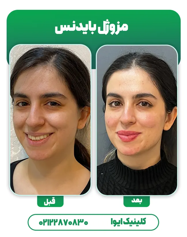 جوانساز بایدنس