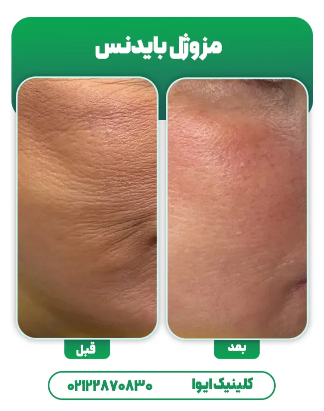 جوانساز بایدنس