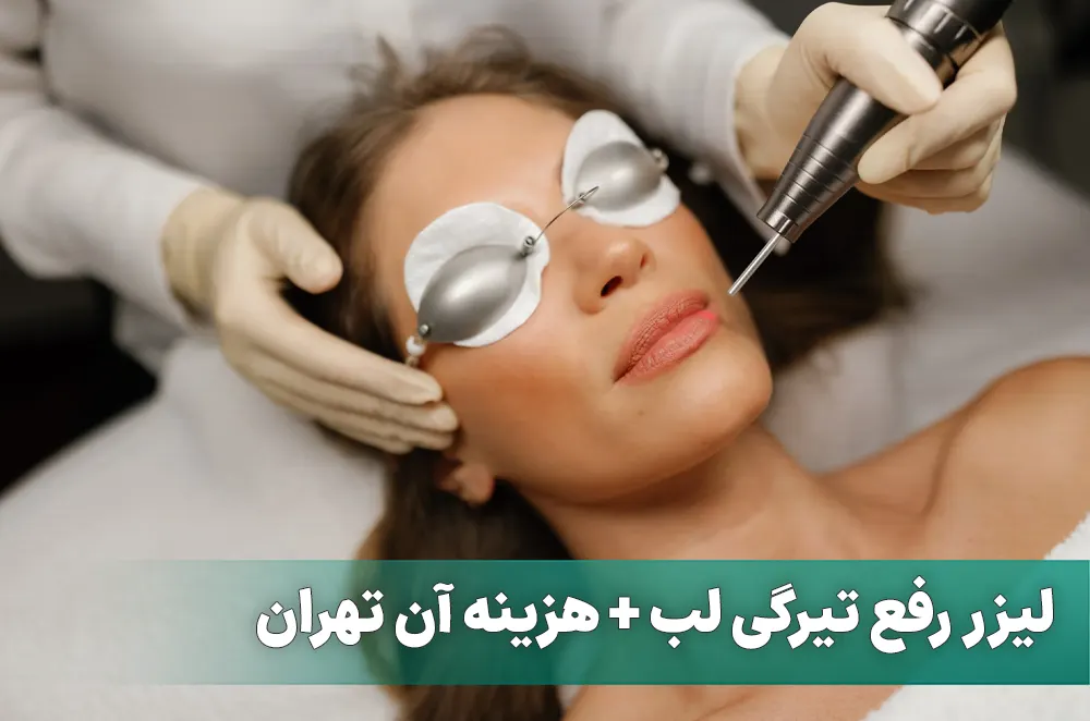 لیزر تیرگی لب