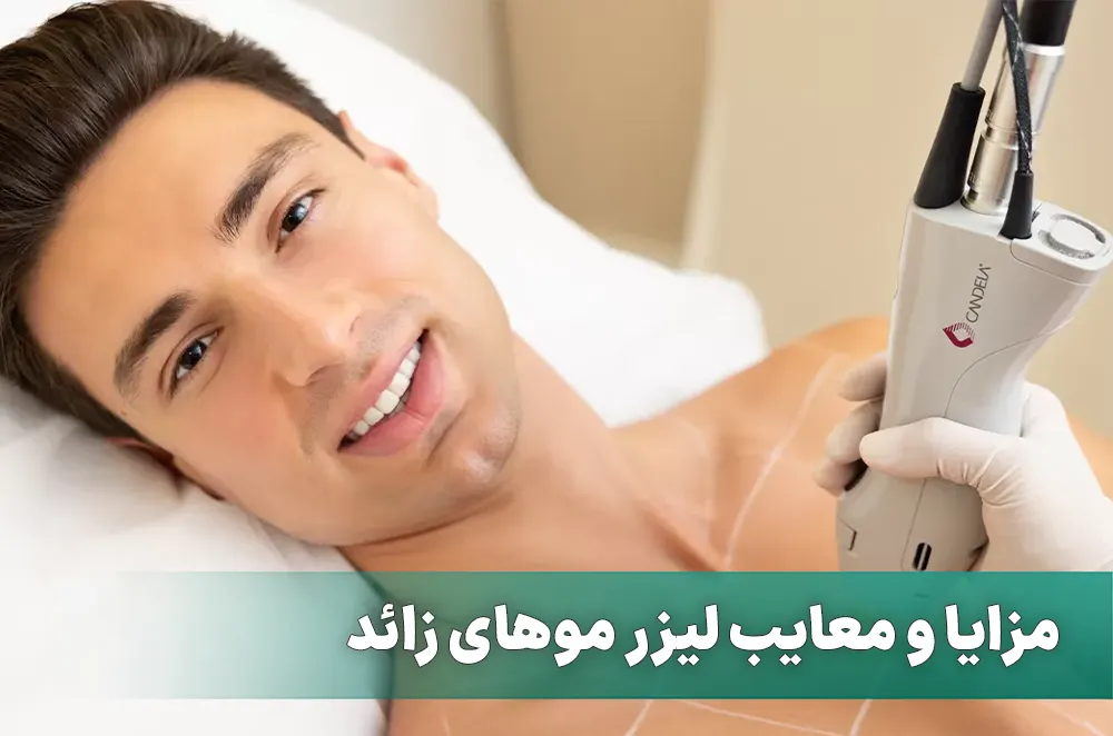 مزایا و معایب لیزر موهای زائد