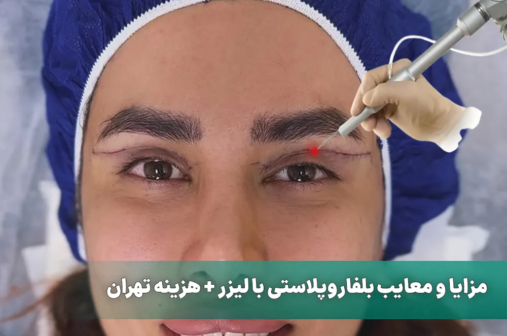 بلفاروپلاستی با لیزر