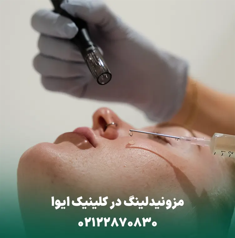 مزونیدلینگ