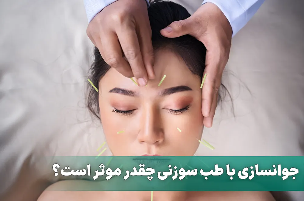 جوانسازی با طب سوزنی