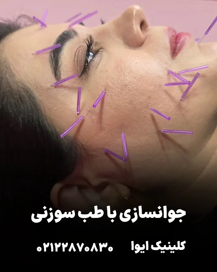 کلینیک جوانسازی با طب سوزنی