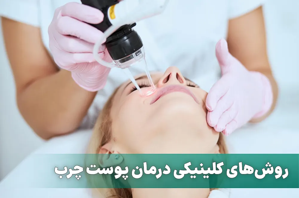 روش‌های کلینیکی درمان پوست چرب