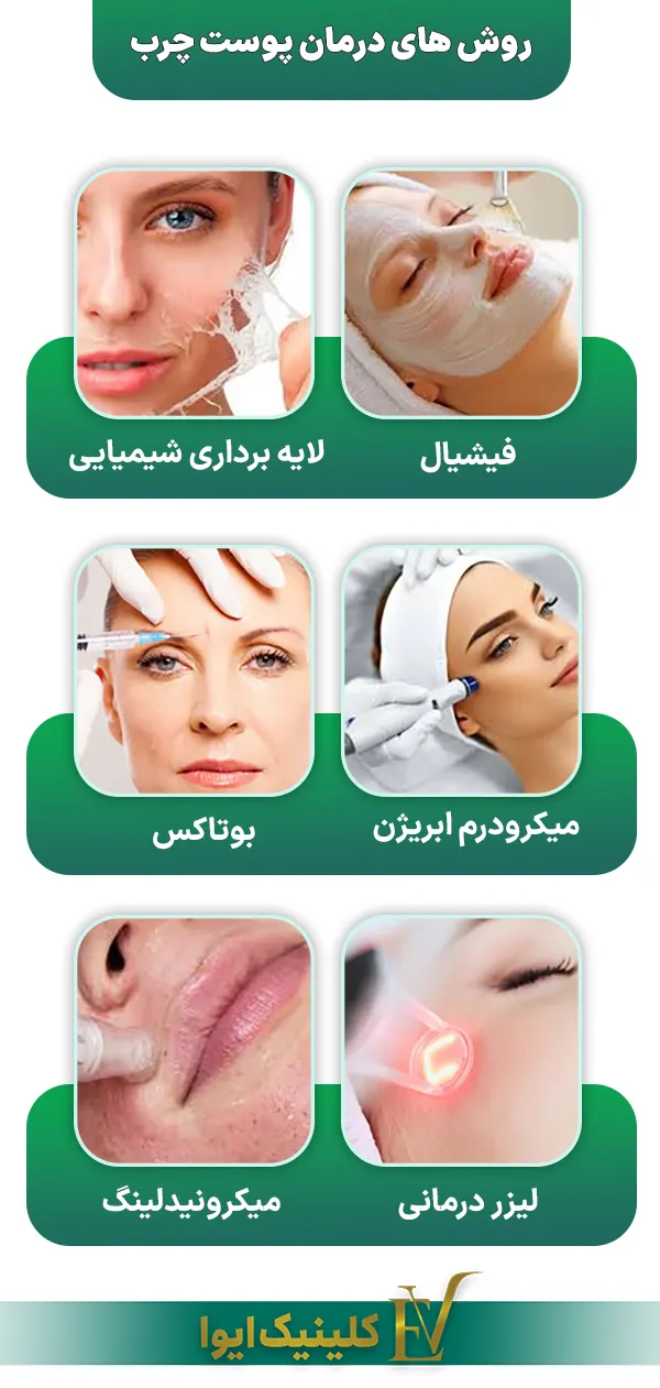 معرفی روش‌های کلینیکی درمان پوست چرب