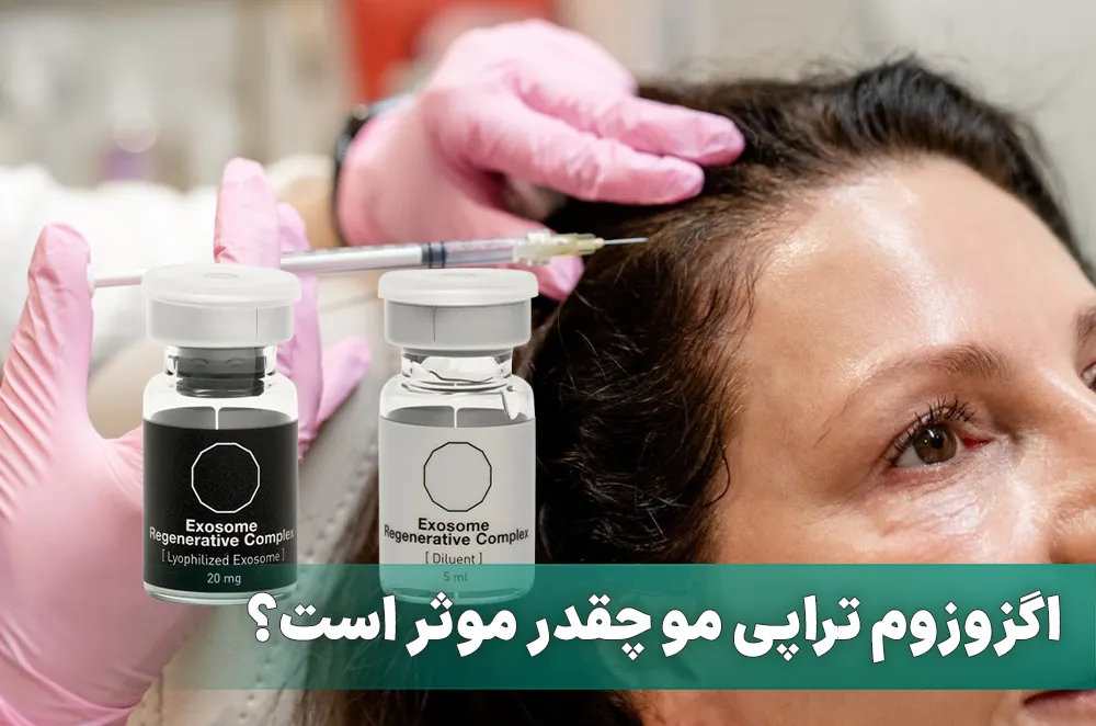 اگزوزوم تراپی مو