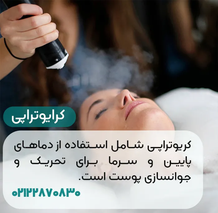 کرایوتراپی صورت