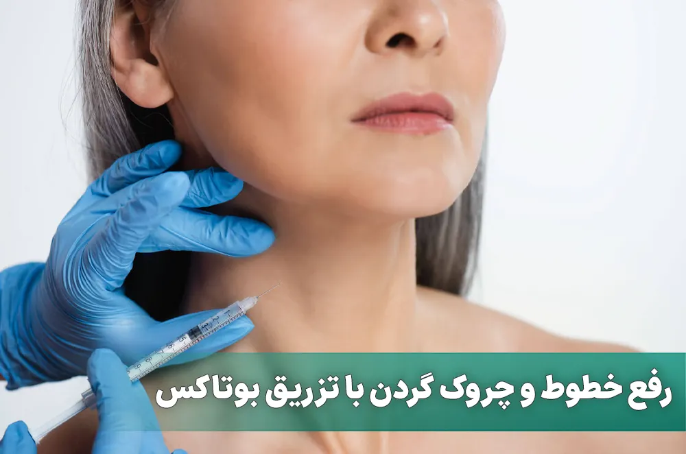 رفع خط گردن با تزریق بوتاکس