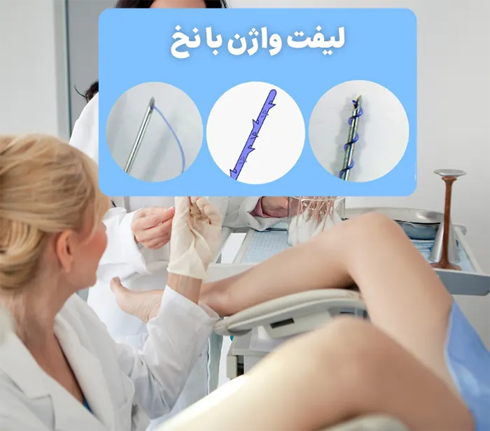 لیفت و تنگ کردن واژن با نخ