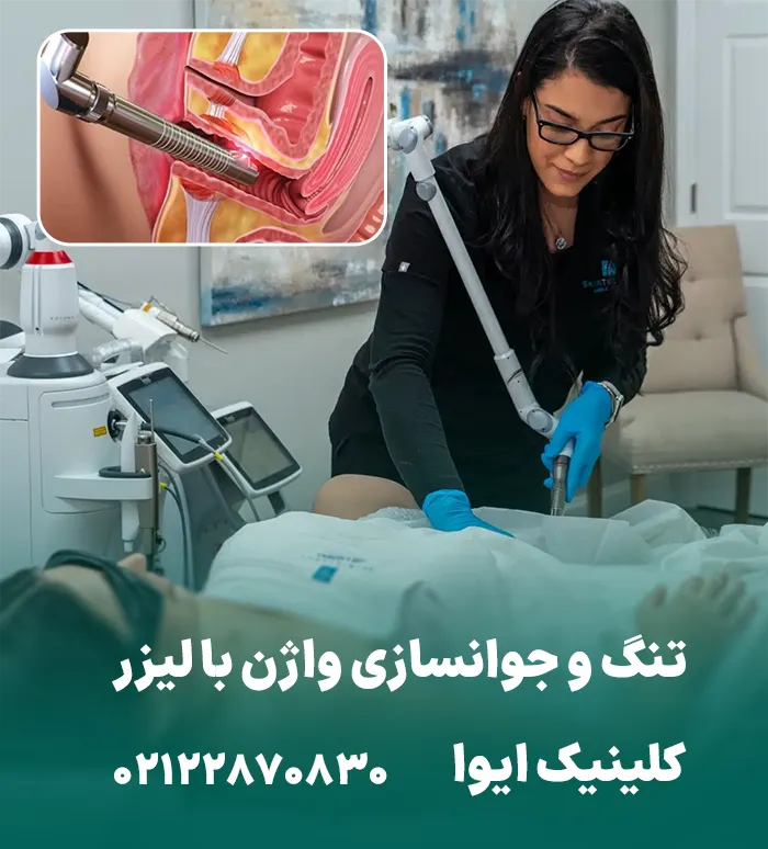 تنگ کردن واژن با نخ