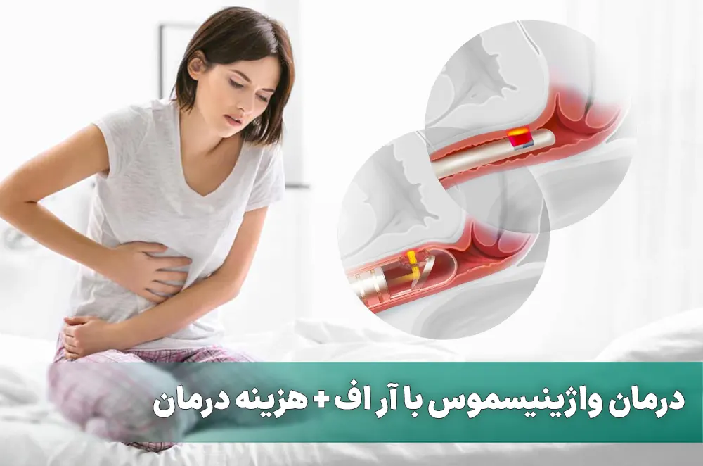 درمان واژینیسموس با آر اف