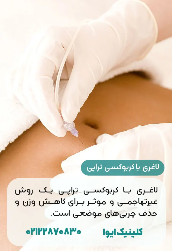 لاغری با کربوکسی تراپی