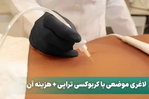 لاغری با کربوکسی تراپی