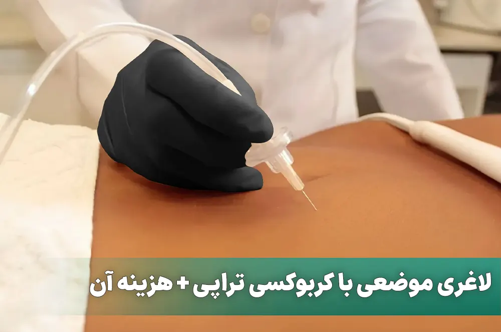 لاغری با کربوکسی تراپی