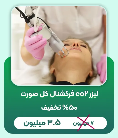 تخفیف لیزر co2
