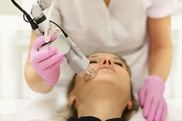 لیزر فرکشنال