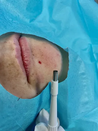 پانچ جای جوش