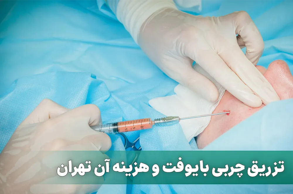 تزریق چربی بایوفت