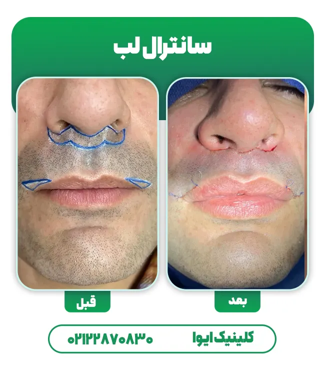 عمل سانترال لب