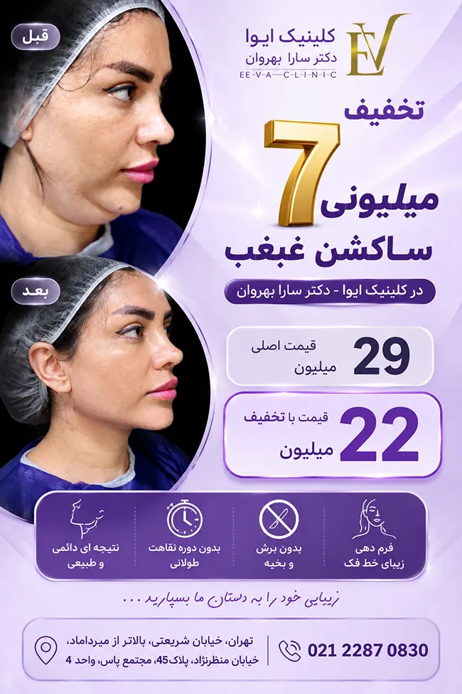 تخفیف ساکشن غبغب