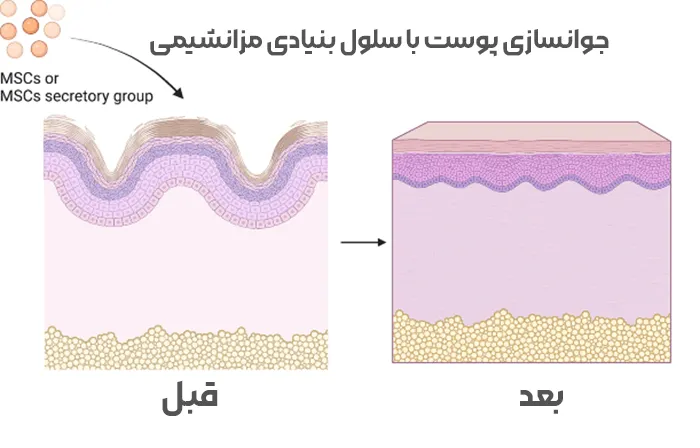 عملکرد اصلی سلول‌ های بنیادی مزانشیمی در جوانسازی پوست