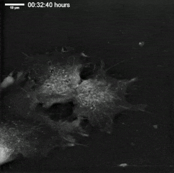 سلول بنيادی مزانشيمی