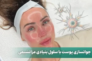 جوانسازی پوست و مو با سلول بنيادی مزانشيمی