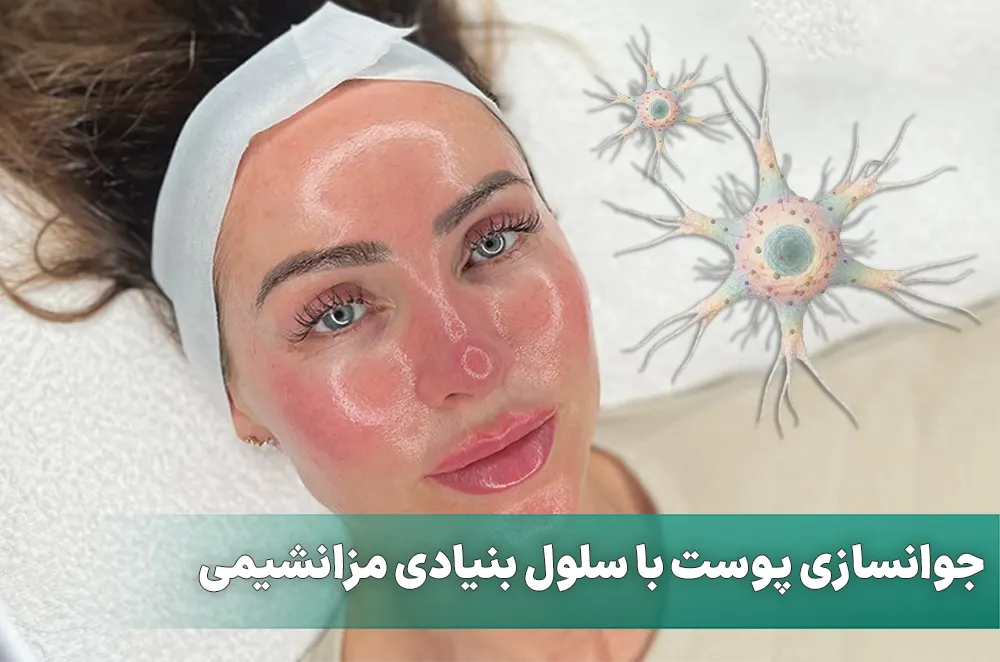 جوانسازی پوست و مو با سلول بنيادی مزانشيمی