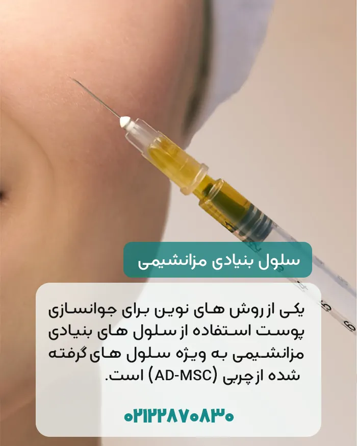 جوانسازی پوست با سلول بنيادی مزانشيمی