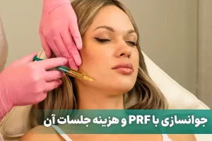جوانسازی با PRF